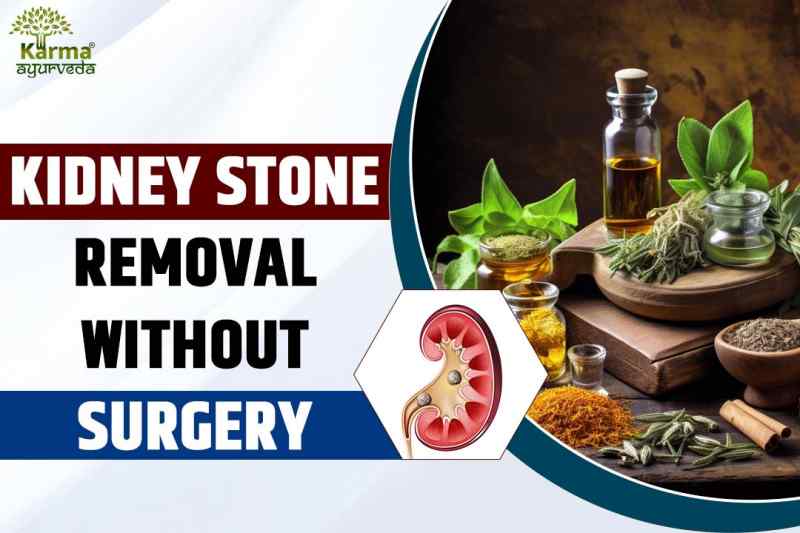 Kidney Stone Removal Without Surgery